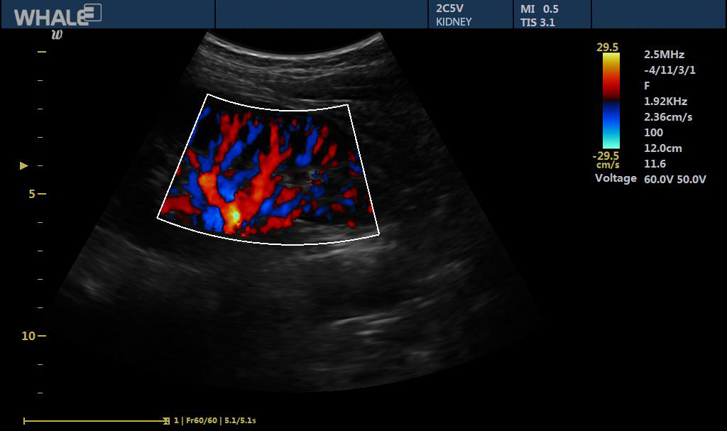 Sigma P5 Clinical Images Kidney