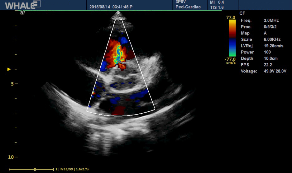 Sigma P5 Clinical Images_Peds