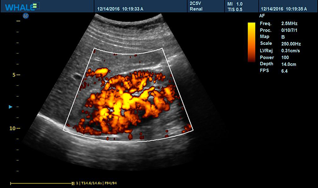 Sigma P5 Clinical Images Kidney