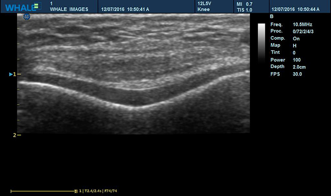 Sigma P5 Clinical Image Knee